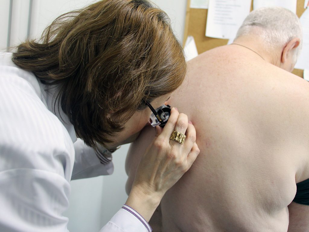 Mês de Combate ao Melanoma reforça importância do diagnóstico precoce