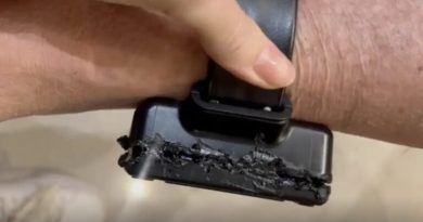 Bolsonaro diz ter usado ferro em tornozeleira devido a curiosidade