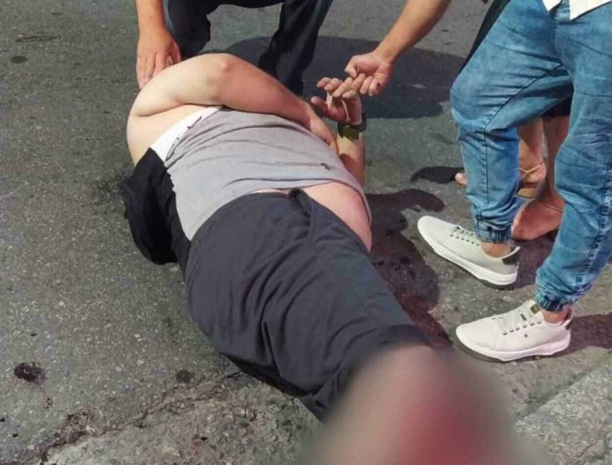 recebe os disparos, um total de cinco, sendo três nas pernas e os outros dois no peito e abdômen.